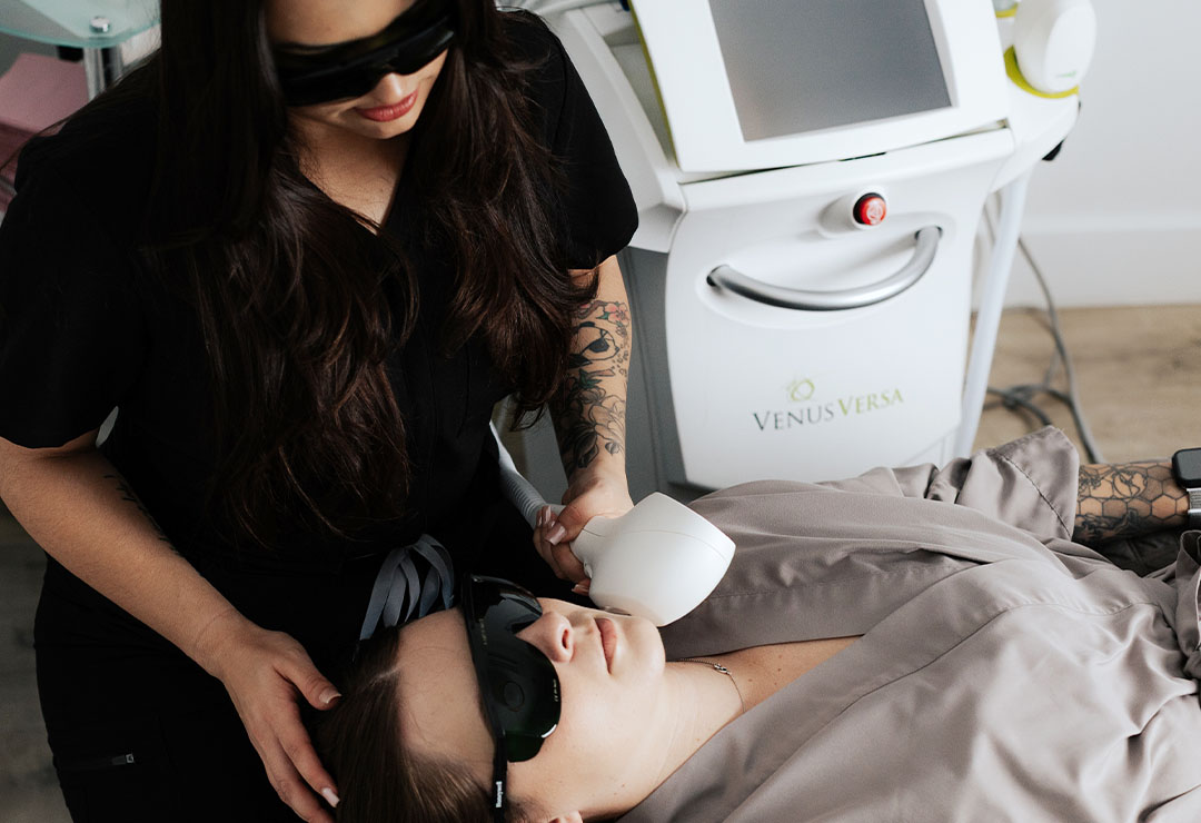 IPL Photofacial at MiraBelle – Mirabelle Aesthetics and Wellness